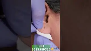 Hole Repair By Ear Pasting lotion/ Ear Repair /Earlobe / Torn Ear lobe Repaired Earlobe -9687889595
