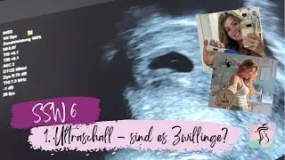SSW 6 - erster Ultraschall: sind es Zwillinge? | wir zeigen euch unser Grundstück! | Schwanger 2023