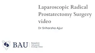 Prostate Cancer- Laparoscopic Radical Prostatectomy Surgery video
