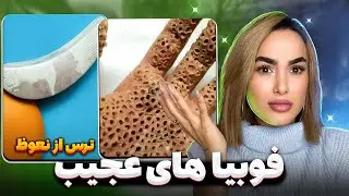 شما چه حسی بهتون دست داد با دیدن ویدیو؟😨#mobixx#phobia