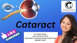Cataract - Dr. Sneha Nayak