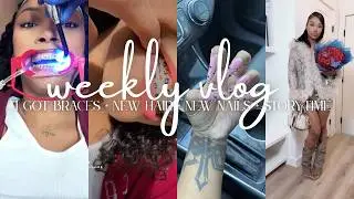 I got Braces VLOG ♡ + Q&A & Story-time