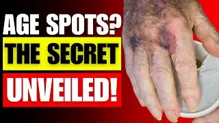 Vanish Age Spots with This Kitchen Miracle!