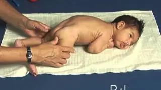 2 month old baby in Prone Position,  Atypical Development
