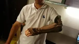 Prótesis mecánica impresa en 3D para muñon corto
