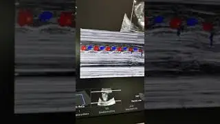 Modo M Color en Ecografía