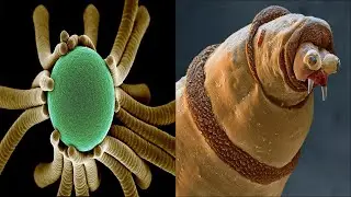 Top 10 Most Astonishing Electron Microscope Pics In The World