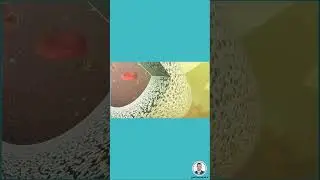 مرشح الغسيل الكلوي