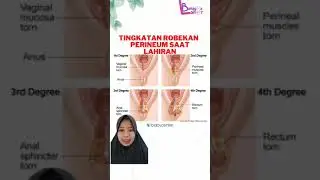 Degree of perineal tear
