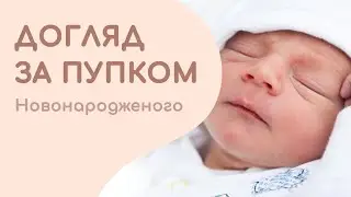 ДОГЛЯД ЗА ПУПКОМ