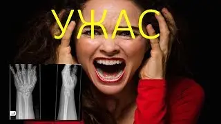 УЖАСНЫЕ ТРАВМЫ(with translation)
