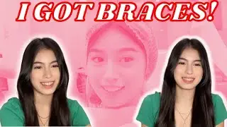 VLOG | Day In My Life: I got braces for the 2nd time! with NovoDental | Heart Ryan