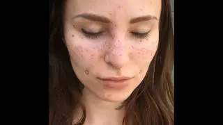 So People Are Actually Tattooing Freckles On Their Face Now