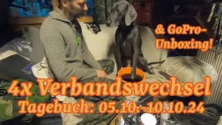 Hütten-Verbandswechsel-Tagebuch Nr.5 & Abonnenten-Gopro-Unboxing