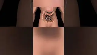 Solve Pooping Problems 