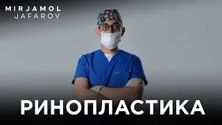 Ринопластика