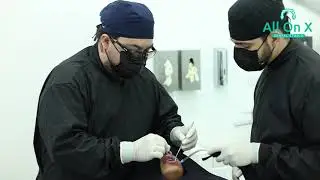 All On X Dental Studio: Leader on dental implants in Los Algodones, México