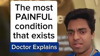 Most PAINFUL Condition Ever? Doctor Explains Cluster Headaches 🧠⚡