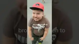 What happened to Mr Beast? 😳😳 #mrbeast #mrbeastshorts  #shorts