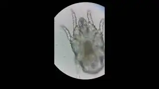 Ушной клещ под микроскопом, отодектоз, ушная чесотка