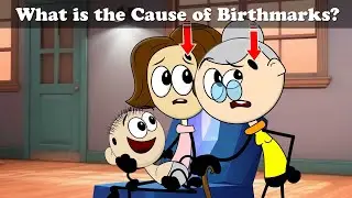 What is the Cause of Birthmarks? + more videos | 