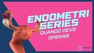 Quando devo operar da endometriose? - ENDOMETRISERIES (Episódio 6)