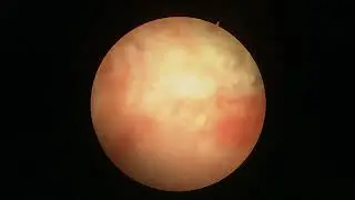 Эмфизематозный цистит у собаки (Emphysematous cystitis in dogs)?