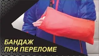 Необычный бандаж при переломе руки.