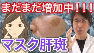 【30〜40代必見！】※要注意〜近年増加傾向にある肝斑(かんぱん)について【肌の悩みQ&A切り抜き】