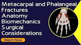 Metacarpal and Phalangeal Fractures - Anatomy | Biomechanics | Surgical Considerations