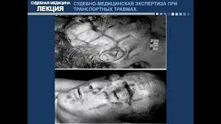 Судебная психиатрия 4 Курс