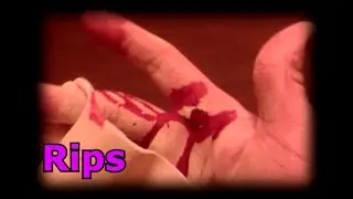 Preventing and Treating Rips for Gymnastics
