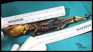 This 'Alien' Skeleton Is Actually Human