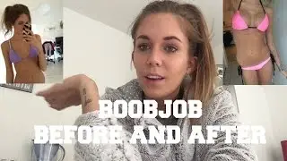 Boobjob before and after