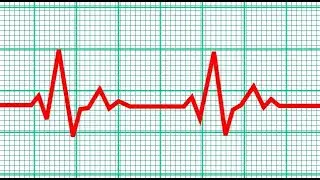 Adobe After Effects - Heart Rate Monitor Effect