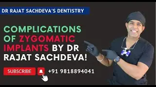 Zygomatic Implants complications | Learn Zygomatic Implants From Dr Rajat Sachdeva