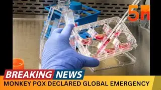 BREAKING NEWS: WHO DECLARE MONKEYPOX AS GLOBAL EMERGENCY