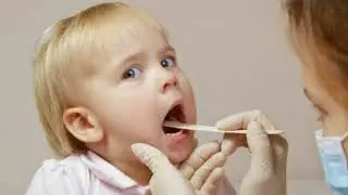 Diphtheria: What Exactly Is It ... And Why Is It Back?