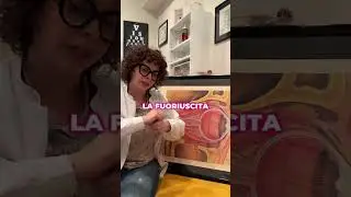 CURIOSITA' ANATOMICHE: occhio secco e ghiandole di meibomio #shorts