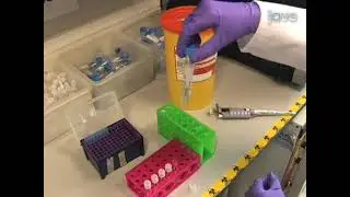 Methods for Visualizing Ca2+ Signaling in Human Sperm