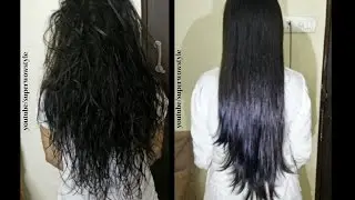 Egg Hair Mask - Silky Shiny Hair! - (Indian Hair Care Secrets) || Damaged/ Frizzy || Hair Growth