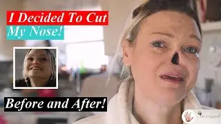 The Woman Without a Nose! ~ Body Bizarre