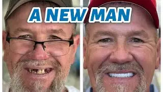 He Didn't Smile Because of His Teeth