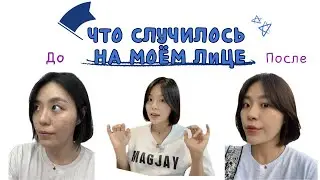 Скинбустер для ухода за кожей! Очень эффективно для сухой кожи💆🏻‍♀️