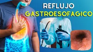 🔥 GERD: Causes, Diagnosis, and Treatment of Gastroesophageal Reflux Disease | Podcast