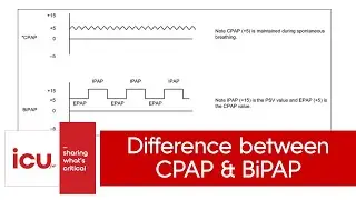 Difference between CPAP and BiPAP | NIV vs CPAP