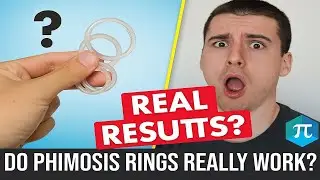 Do Phimosis Rings Really Work? Shocking Results Revealed!
