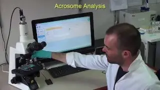 CASA System SCA Production