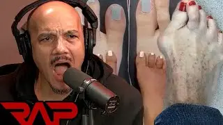 World's Ugliest Feet