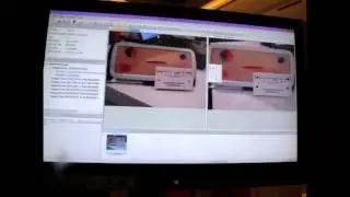 Ricoh Dynamic Capture Solution for Wound Care